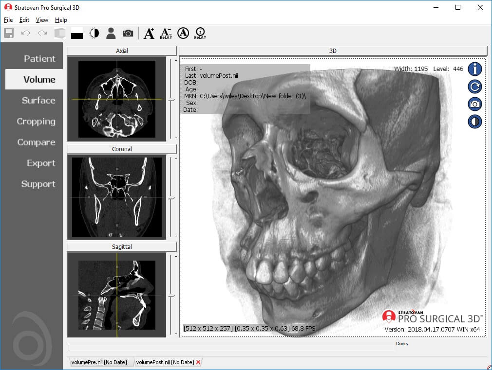 ProSurgical3D - Gemaakt door PostDICOM